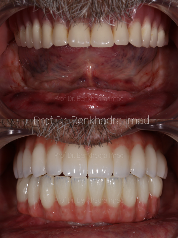 InCollage_20250727_210722977